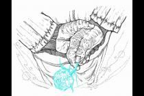 ÿ˫�Ͷ����ֶ�����